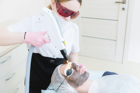 The cosmetician girl in goggles makes the procedure of carbon peeling with the help of a cosmetology laser. Carbon face peeling procedure.の写真素材