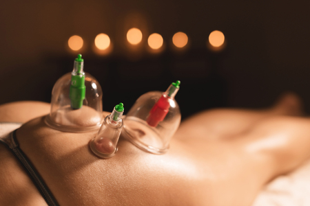Close-up of three wet caps for vacuum massage installed on the young girls buttock against the background of burning candles in a dark roomの写真素材