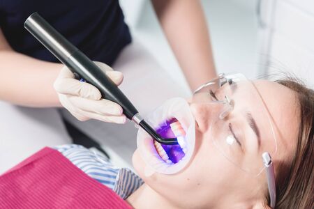 Close-up of a dentist and nurse making a dried new filling with ultraviolet young female patient in the dental officeの写真素材