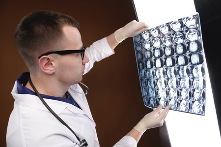 Portrait of a young doctor with glasses and a stethoscope around his neck against a wrinkled background. Holds an X-ray picture in his hands and looks at the camera with a slight smileの写真素材