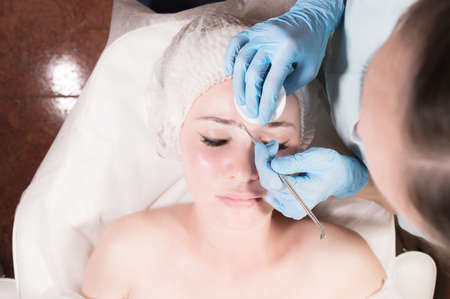 Close-up Professional face cleaning. Mechanical face cleansing procedure. Peeling of the skin of the...