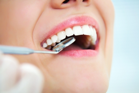 Close-up of young female having her teeth examinatedの写真素材