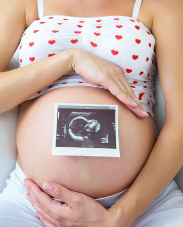 Pregnancy woman holding ultrasound picture her babyの写真素材