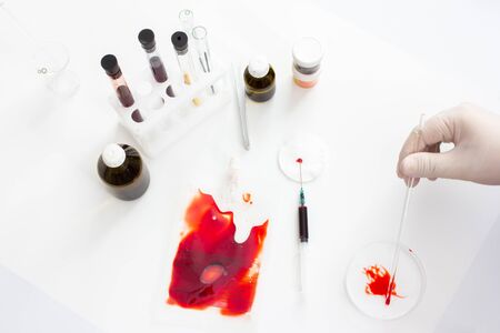 Coronavirus vaccine development. Laboratory for research of blood of patients with virusの写真素材