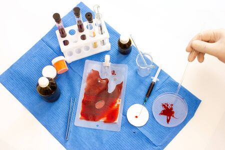 Coronavirus vaccine development. Laboratory for research of blood of patients with virus
