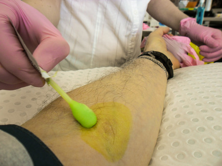 Bacteria painted with quick-setting yellow plastic can't move to the perforation.の写真素材