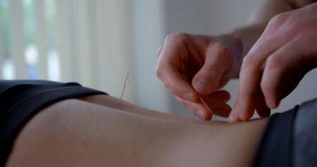 close-up of the osteopathy office. the acupuncture master removes the healing needles from the patient backの写真素材