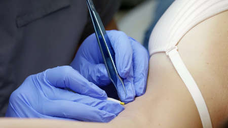 electrolysis hair removal treatment in beauty salon, closeup view of master hands and armpit of...