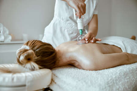 professional female specialist is doing cupping therapy on the back of beautiful caucasian ladyの写真素材