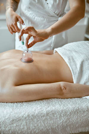 professional female specialist is doing cupping therapy on the back of beautiful caucasian ladyの写真素材
