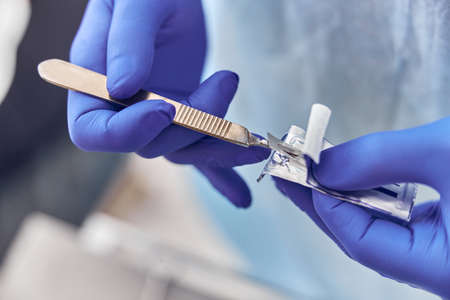 Confident doctor is preparing a scalpel for dental operationの写真素材