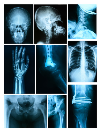 Collage of many X-rays. Very good qualityの写真素材