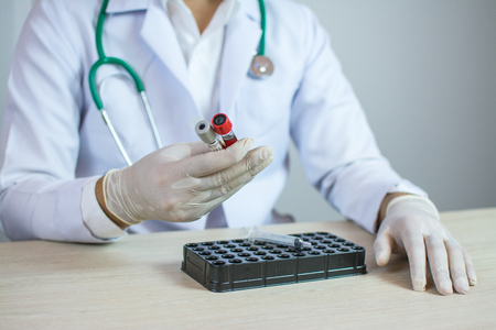 doctor holds a blood sample tube in his hand testing in the laboratoryの写真素材