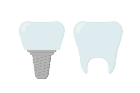 Cartoon Tooth and dental implant for stomatology or dentistry template. isolated vector illustrationのイラスト素材