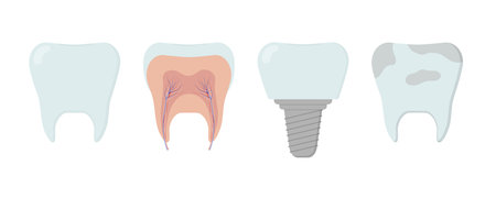 Clean healthy tooth, dental implant, dirty tooth, tooth inside. Template for dentistry or dentistry...