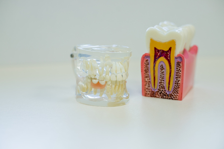 Oral health, tooth decay and sugar destroys the tooth enamel concept with plastic medical model of teeth or dentures . Teeth model for education. Dentist office. Copy space. Tooth healthの写真素材