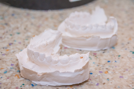 Plaster impression of teeth. Dental plaster mold. Dental mold showing teeth on a table viewed side on in a dentistry oral hygiene and healthcare conceptの写真素材