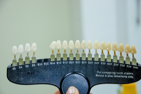 Dentist checking and selecting color of young mans teeth, closeup. teeth color chart. Plastic dental implant for choose color tone of teeth.Cosmetic dental services.Oral hygiene. Dental careの写真素材