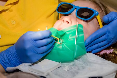 Dentists with a patient during a dental intervention to girl. Dentist Concept.dental treatment under local anesthesia.The concept of health, oral hygiene, people and beauty.の写真素材