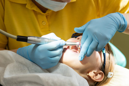 close-up medical dentist procedure of teeth polishing