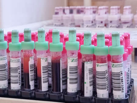 Moscow, russia, 02 may, 2021.rack with colored tubes in the laboratory workbench. analysis of blood samples.Blood tube for testing in Bio Chemistry aboratoryのeditorial素材