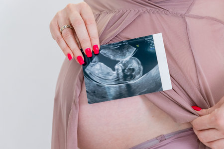 Close-up of hands holding ultrasound images over a pregnant belly. Pregnancy, ultrasound, and...