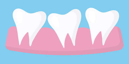 Illustration of three teeth. Three jagged teeth. The concept of uneven teeth.のイラスト素材