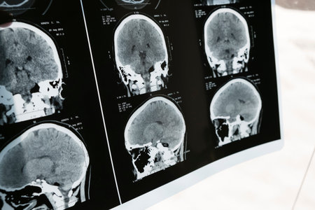 Closeup of a CT scan and skull on it. health medical image of an mri of the head showing the brain...