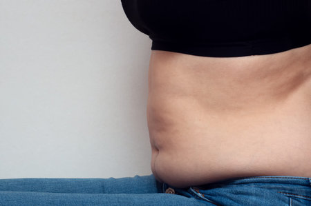 Overweight fat woman showing her belly fat side view close up