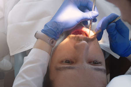 Man on examination at the dentist. Cleaning plaque and tartar in a dental clinic. Preventive Dental hygiene and check upの写真素材