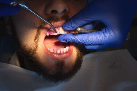 Professional oral hygiene and teeth cleaning. Applying the gel to the teeth. Prevention of caries and gum diseases.の写真素材