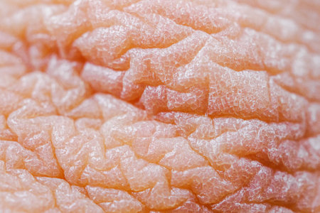 Dry skin or ichthyosis texture detail. Extreme close up macro shot dehydration skin. Dermatology and skincare conceptの写真素材