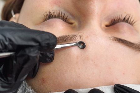 Mechanical facial cleansing with metal device at the beautician clinic. Cosmetology Professional procedure for cleansing pores and skin from defects Close-upの写真素材
