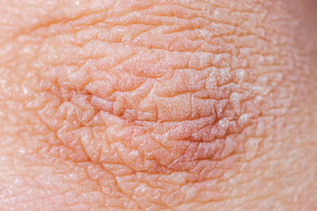 Dry skin or ichthyosis texture detail. Extreme close up macro shot dehydration skin. Dermatology and skincare conceptの写真素材