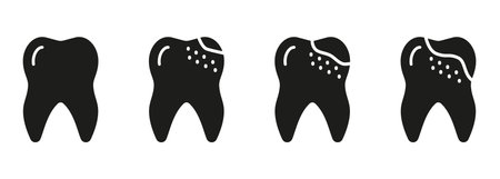 Orthodontic Teeth Problem. Dental Caries Process Silhouette Icon Set. Dental Treatment Sign. Tooth Disease Stages Glyph Pictogram. Dentistry Solid Symbol. Isolated Vector Illustrationのイラスト素材