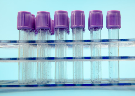 Blood collection tube