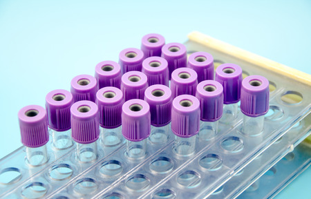 Blood collection tube