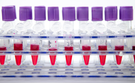 Blood collection tubeのeditorial素材