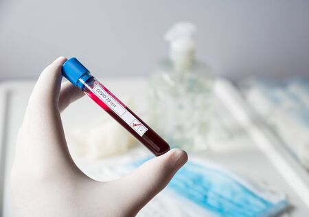 test tube  inscription virus, coronavirus study, virus researchの写真素材