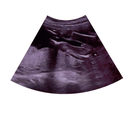 Ultrasound image report on white background