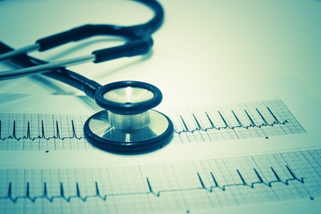 Stethoscope and Electrocardiography (ECG or EKG) Isolated on the White Background
