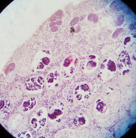 Rare material, with microscope -- a section of the fish