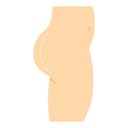 Plastic surgery, buttocks correction, icon.のイラスト素材