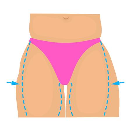 Hip plastic correction icon. Cartoon illustration of hip plastic correction vector icon for webのイラスト素材