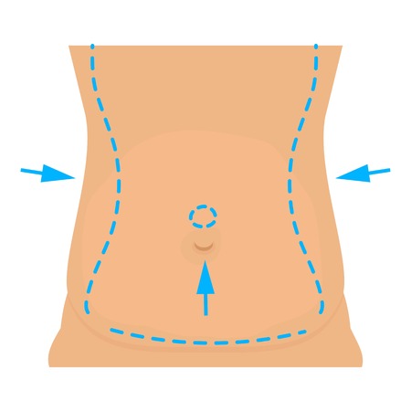 Waist plastic correction icon. Cartoon illustration of waist plastic correction vector icon for webのイラスト素材