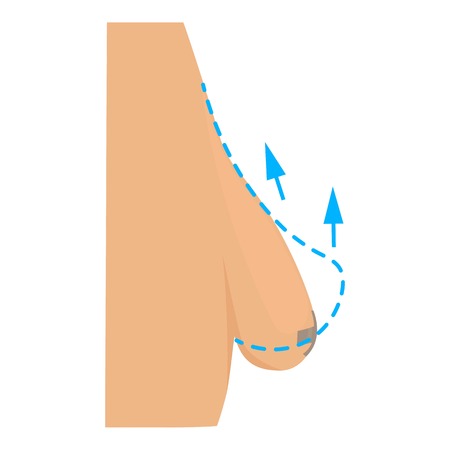 Breast plastic correction icon. Cartoon illustration of breast plastic correction vector icon for webのイラスト素材