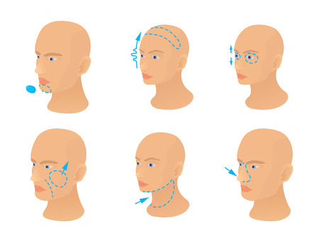 Head operation icon set, cartoon styleのイラスト素材