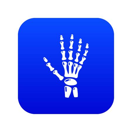 Inflammation of hand icon. Simple illustration of inflammation of hand vector icon for web.のイラスト素材