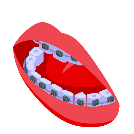 Woman tooth braces icon, isometric styleのイラスト素材