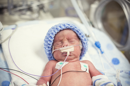 Newborn premature baby in the NICU intensive careの写真素材